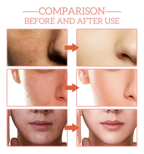 2 Unidades De Sérum Facial 5 En 1, Aceite Facial Con Vitamin