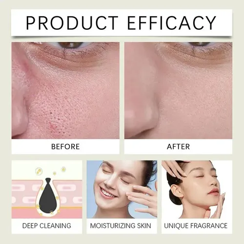 Nn Mascarilla Limpiadora Coreana Con Green Tomate Cl Clay