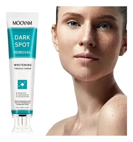 Crema Blanqueadora De Pecas Crema Eliminadora De Pecas Yy