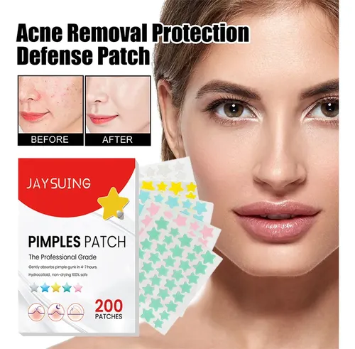 Parches Invisibles Para Eliminar Espinillas Ii Beauty Acné,