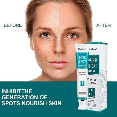 Crema Facial Gel Blanqueadora De Pecas Manchas Acne Rosaceas