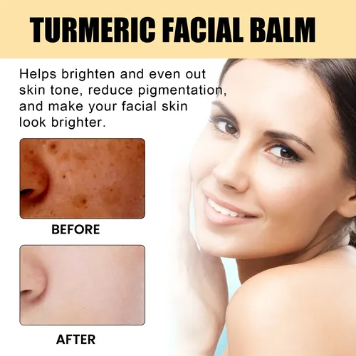 Barra Iluminadora Facial De Cúrcuma Eelhoe Para Piel Suave Y
