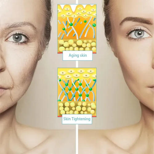 Crema Antienvejecimiento Boost Lift, Hidratante Y Antiarruga
