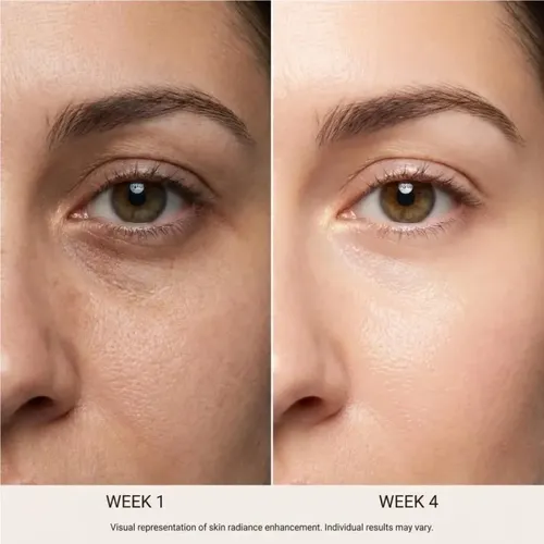 A Crema Para Ojeras Y Ojos Hinchados, Crema
