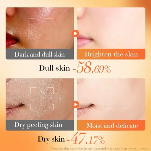 Crema Hidratante Bioaqua Ve + B5, Reparadora E Iluminadora Momento De Aplicación Día/noche Tipo De Piel Mixta
