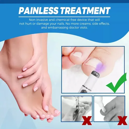2×pluma Hongos Uñas Calientes Pluma Láser Luz Azul