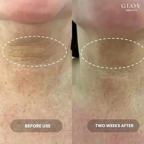 Crema Cuello Lifting Glov Beauty 6.1\x201d X 1.46\x201d
