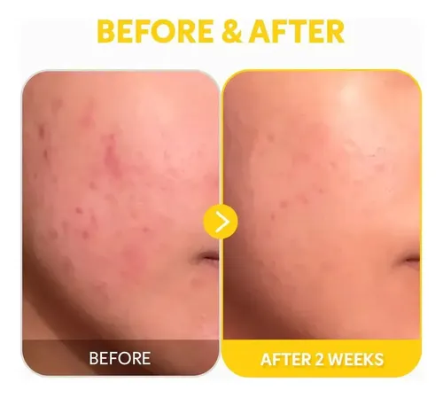 Sérum Tirtir Pure Vitamina C24 para una Piel Luminosa y Antiedad