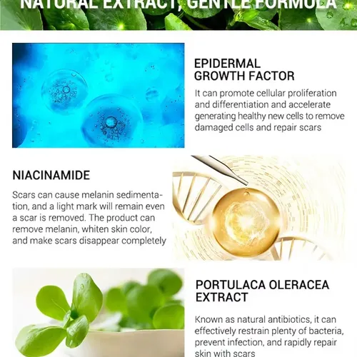 Cca Xt Crema Para Eliminar Estrías, Cicatrices Y Acné /dd