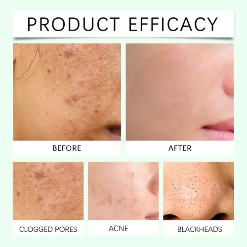 Mascarilla Facial De Arcilla Calmante Papa Feel Mugwort Todo Tipo De Piel