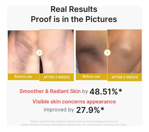 ‘suero Exfoliante Cuerpo Kójico Cúrcuma Más Paño Baño’