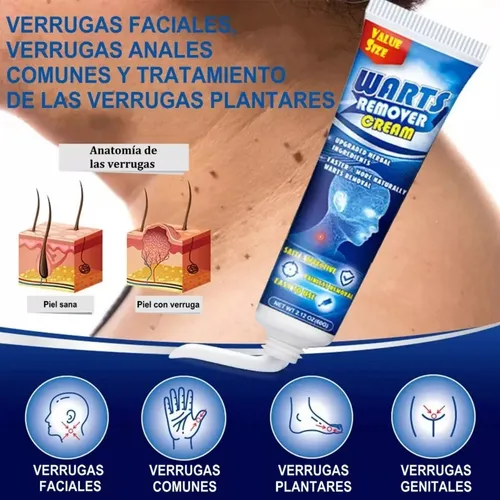 2× 60g Crema Verruga Verruga Pomada For Ojos De Maíz Plana