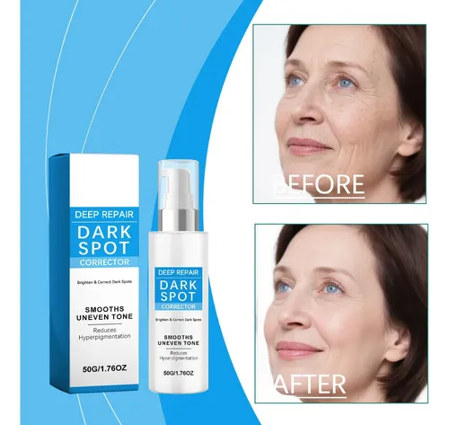 Esta Crema Iluminadora Ayuda A Mejorar La Opacidad De La Gra