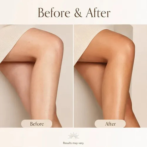 Gel Hidratante Hidratante Y Ennegrecido Self-tanners Para Ro