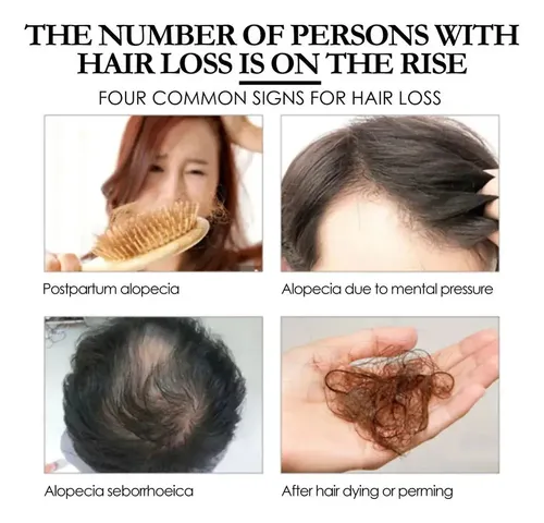 Esencia Para El Crecimiento Del Cabello Xinnuo Oil 111