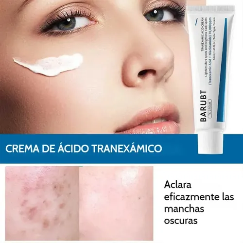 Zy Crema Fb Para Manchas Con Ácido Tranexámico 1 Pieza.. A+