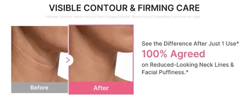 Medicube Pdrn Collagen Gua Sha Neck Wrinkle Cream Todo Tipo De Piel Día/noche