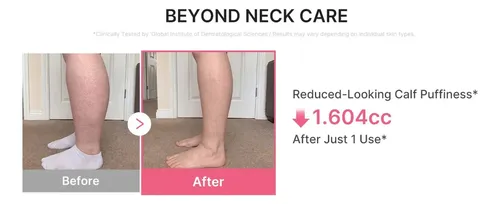 Medicube Pdrn Collagen Gua Sha Neck Wrinkle Cream Todo Tipo De Piel Día/noche