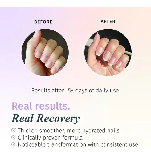 Duri Rejuvacote 2 Base Y Top Coat 3-pack Fortalecedor Uñas