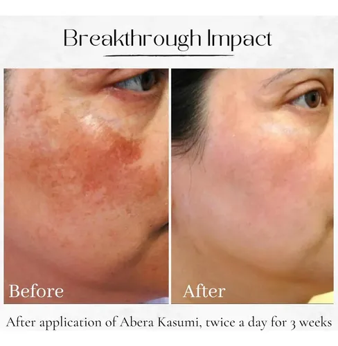 Crema Antimanchas Kasumi Con Niacinamida Y Ginseng 19.84g