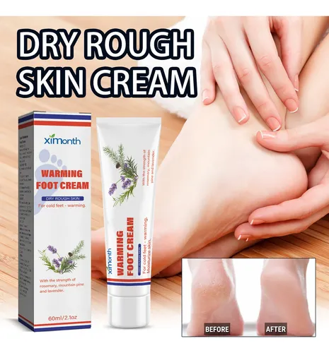 La Crema Para El Cuidado De Los Pies Ximonth Alivia E Hidrat