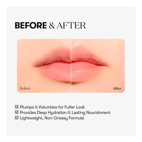 Vt Lip Plumper Reedle Shot Beginner Ácido Hialurónico 4.3g