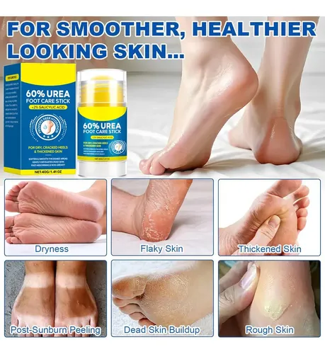 Zj Crema De Manos Y Pies Con Urea, 40 G, 1 Unidad Y Gtzll