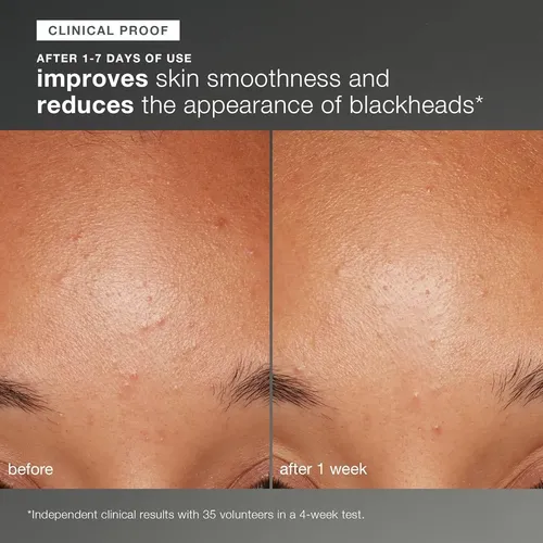 Dermalogica Exfoliante Facial Con Enzima De Papaya. Brillo