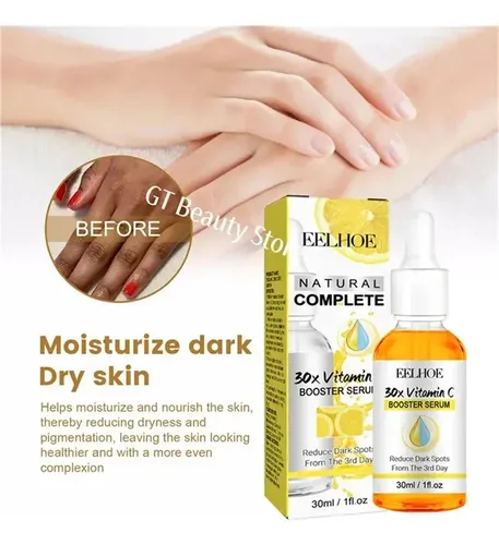 Sérum Iluminador Dark Knuckles Para Codos, Rodillas Y Piel O
