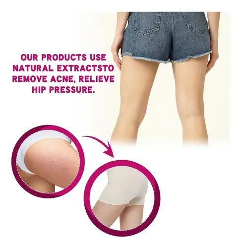 C Crema Para El Acné De Glúteos, Eliminación De Espinillas