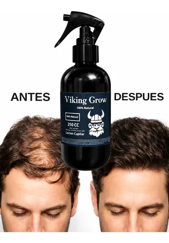 Locion Anticaida Cabello Y *crecimiento Para El Pelo*