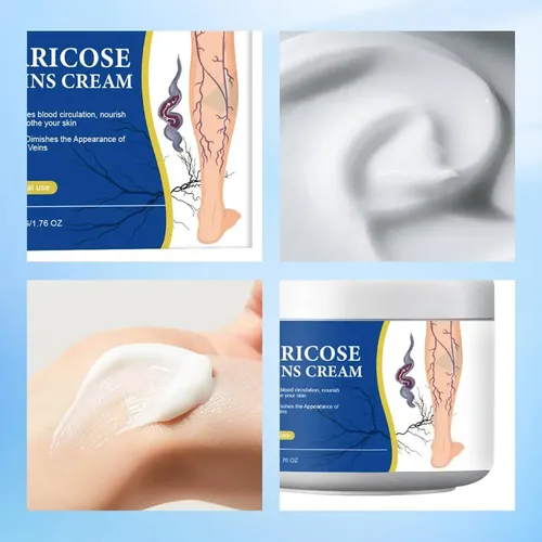 Crema Para Alivio De Várices Y Arañitas En Piernas 150g General