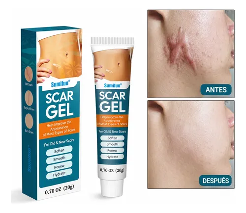 Crema Gel Reparadora Cicatrices Queloide Acne Quemadura Scar