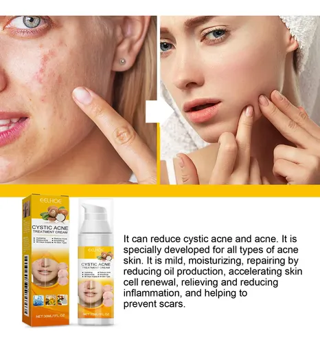 Sérum Facial Eelhoe Para Una Piel Clara Y Minimizar Los Poro