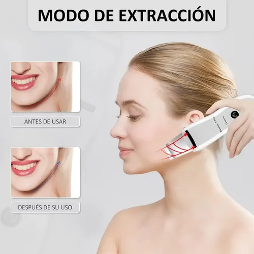Limpiador Facial Ultrasónico Rostro Eléctrico Recargable