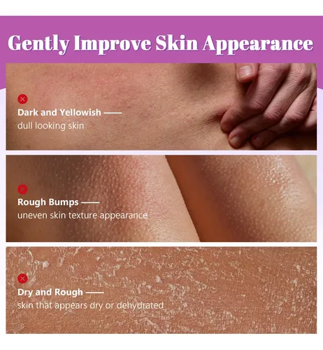 Exfoliante Corporal Xinszlin 7% Aha Y 0,5% Bha