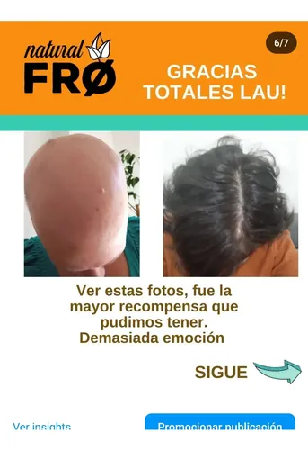 Loción Capilar Caida-crecimiento Capilar Naturalfro X 100ml