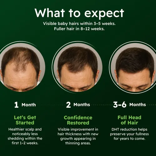 Kkidgtratamiento Nutritivo Para Cuero Cabello Tuinutriti
