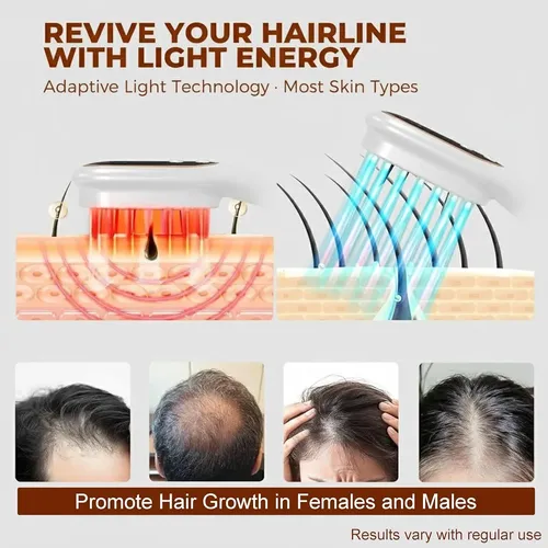 Peines El Cuidado Del Cuero Cabelludo Y Favorecer El Cabello