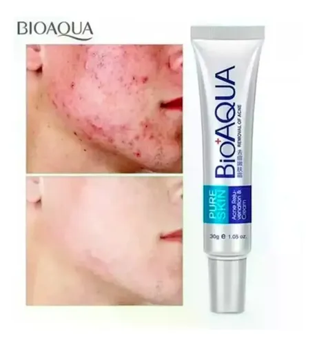 Crema Para El Acné Bioaqua Cicatrices Poros Control Full Gra
