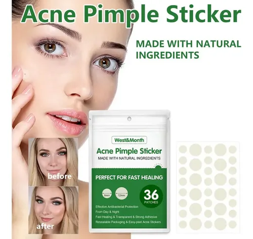 Parche Impermeable Para El Acné Que Absorbe Las Espinillas,