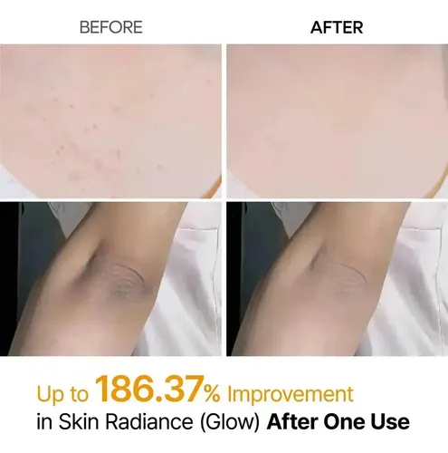 Un Dr. Dr. Melaxin Spray Exfoliantes Corporales Con Ácido De