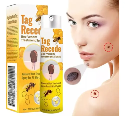 Zspray Para Verrugas Con Veneno De Abeja Para Reparar La Pie