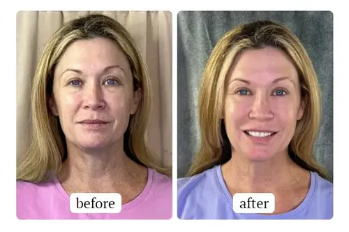 O Tratamiento Antienvejecimiento South Beach Skincare All