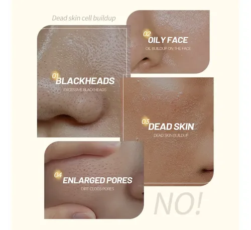 Whaceite Esencial Suave Exfoliante De Piel De Naranjawq