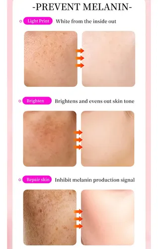 Crema Facial Antimanchas Despigmentante Melasma Paño 30 G Ll
