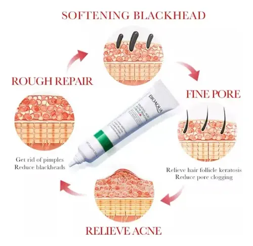 Crema Antiacné Con Ácido Salicílico Para Piel Grasa 20 G, Z