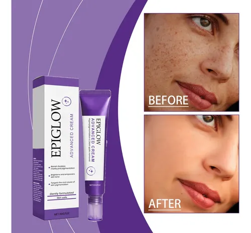Crema Despigmentante Y Aclarante Facial 30g Para Piel