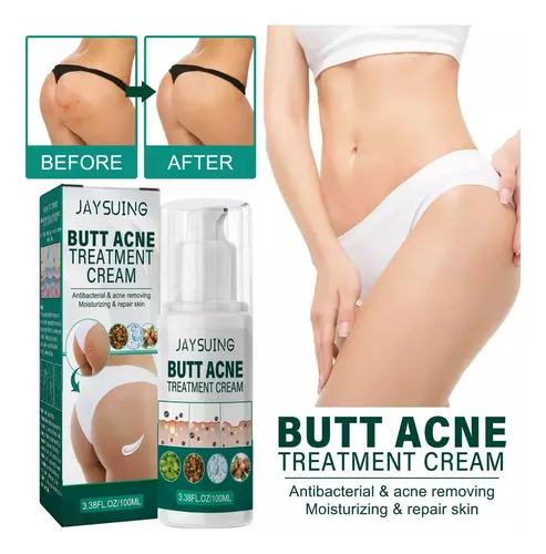 Crema Reparadora De Acné En Glúteos De 2 Piezas, Hidratante