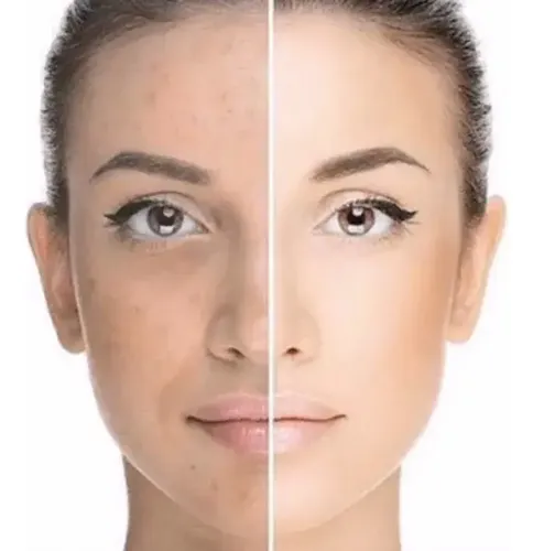 Radian C Brightening Serum Ácido Hialuronico Lidherma